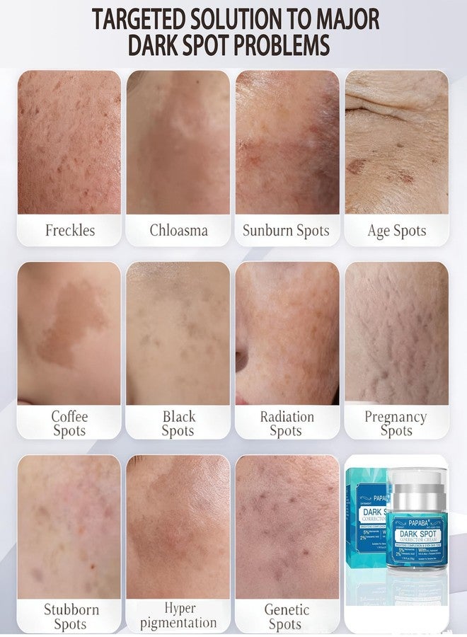 PAPABA Tranexamic Acid Serum Dark Spot Corrector Cream for Face & Body Women Men - Niacinamide + Vitamin C - Brightening Treatment for Age Spots, Sun Spots Gentle for Sensitive Skin - Image 5